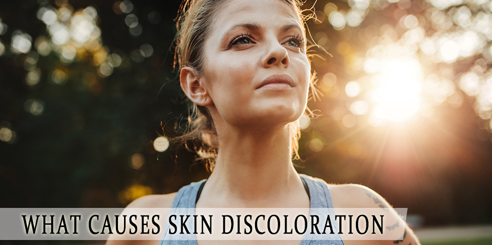 Skin discoloration causes